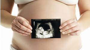 Neue studien zeigen, dass die aussagekraft dieses screenings von 11 bis zu 13 schwangerschaftswochen abnimmt. Ersttrimesterscreening Alle Infos Auf Einen Blick Echte Mamas