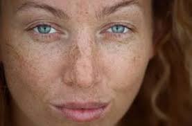 Le Bicarbonate De Soude Est Le Remede Naturel Pour Enlever Les Taches Brunes Vous Melangez Le Bicarbonate Age Spots On Face Age Spot Remedies Age Spot Removal