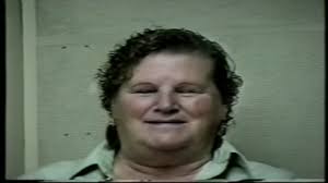 Interventions for Parkinson's Disease