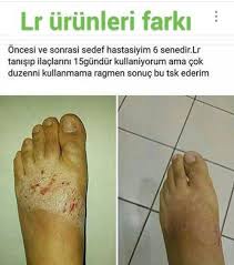 Seval Atalay Adli Kullanicinin Lr Aloe Vera Facebook Olcay Dignef Panosundaki Pin Aloe Saglik