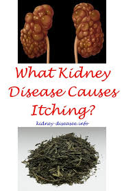 Pin On Kidney Transplant