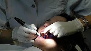 Trouvez les adresses qui vous intéressent sur le plan de tourcoing. Y A T Il Toujours Un Dentiste De Garde Joignable Le Dimanche