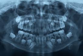Understand the benefits and drawbacks of implementing digital radiology in a dental office. Pediatric Dental X Rays 4s Pediatric Dentistry Dentist Orthodontist
