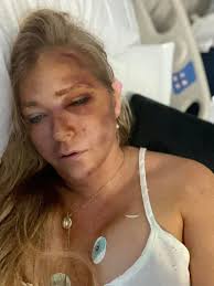 Prince Andrew accuser Virginia Giuffre says she's in hospital after car  crash with a school bus