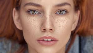 Image result for Freckled skin