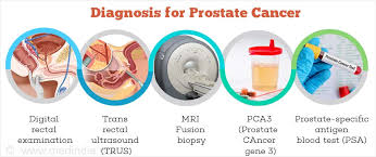 In men who have prostate cancer that is more advanced or that has spread to areas of the body beyond the prostate gland, the following symptoms may occur: Prostate Cancer Cancer Of Prostate Incidence Prevention Causes Symptoms Treatment