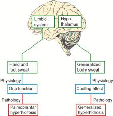 Image result for Hyperhidrosis Causes