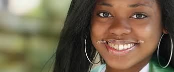 It's tiktok's first ever teeth whitening filter now you can film and post your tiktok with your new white teeth! Whiten Teeth In A Photo Get Whiter Eyes For A Beautiful Portrait