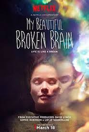 The film is based on susannah cahalan's memoir brain on fire: My Beautiful Broken Brain Wikipedia