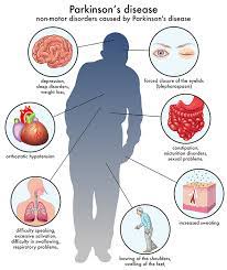 Living with parkinson's disease is caused by a loss of nerve cells in the part of the brain called the substantia nigra. Parkinsons Disease German Neuroscience Center Dubai