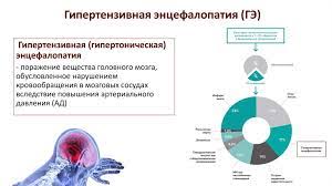 We did not find results for: Lechenie Gipertonicheskogo Kriza U Pacientov S Gipertenzivnoj Encefalopatiej Prezentaciya Onlajn