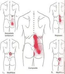 Pin On Pain