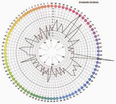 Farnsworth Munsell 100 Hue Test Result Of A Patient With