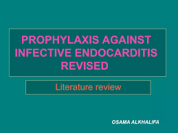 Image result for SBE Prophylaxis