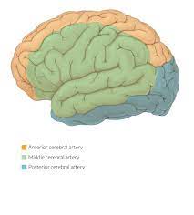 2.2 cerebral hemispheres (carotid/anterior circulation) stroke in this vascular distribution often results in contralateral paralysis or weakness (hemiparesis/hemiplegia), sensory loss and visual field loss (homonymous hemianopsia) (adams, 1997). Overview Of Stroke Amboss
