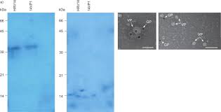 Rhinovirus rhinovirus molecular surface of a rhinovirus, showing protein spikes virus classification group: Antibodies Induced With Recombinant Vp1 From Human Rhinovirus Exhibit Cross Neutralisation European Respiratory Society