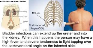 About Urinary Tract Infections From A Preparedness Standpoint Remedies For Kidney Infection Health Info Holistic Approach To Health