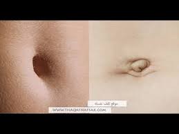 تحديد نوع الجنين من شكل السرة معرفة نوع الجنين من خلال نعومة بشرة البطن youtube