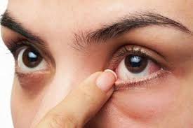 Uveitis dapat menyebabkan masalah lain seperti glaukoma (tekanan. Bukan Firasat Kejadian Buruk Mata Kedutan Ternyata Jadi Gejala Penyakit Berbahaya Ini Harus Segera Ke Dokter Semua Halaman Sajian Sedap