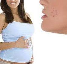 Jun 18, 2021 · namun, pada ibu hamil, pemakaian produk skincare harus diperhatikan. Jerawat Pada Saat Hamil