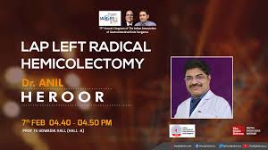 Lap Left Radical Hemicolectomy Therightdoctors Mashoor gulati wherein he is doing a regular health check up of anil kapoor and finds that anil kapoor's bp is extremely low.