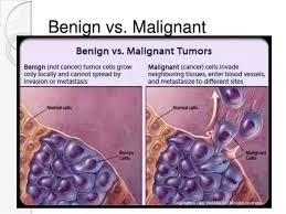 Cells the tumor is then called malignant or cancerous. What Is A Tumor And What Is Cancer Quora
