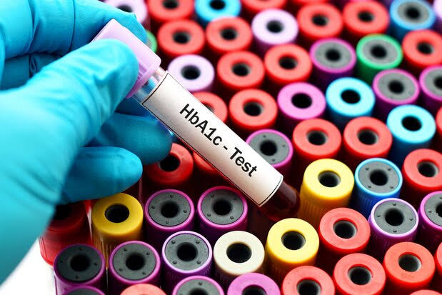 HBA1C product image
