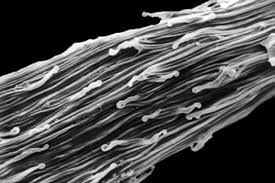 Image result for Microcoelia obovata