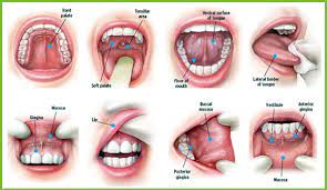 Swellings/thickenings, lumps or bumps, rough spots/crusts/or eroded areas on the lips, gums, or other areas. Oral Cancer Screening Test Nyc Rockefeller Cosmetic Dentistry