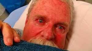 Patrick Tillett: Fire Sticks Versus My Eye Balls