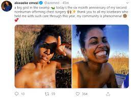 My surgeries were a bridge across realities, a spirit customizing its vessel to reflect its nature. Nigerian Writer Akwaeke Emezi Goes Topless To Reveal Her Mastectomy Scars After Breast Removal Surgery