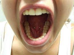 Q Hello I Was Wondering If You Could Give Me Some Information On Tongue Frenulum Piercings If Done Properly Are They Permanent If I Want To Wear A Cbr With