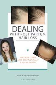 So hair loss after pregnancy is normal and unavoidable. Hair Loss After Pregnancy