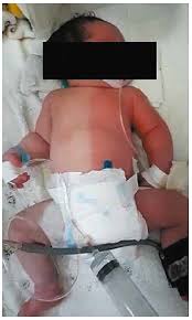 Image result for Harlequin Color Change