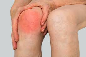 Image result for Septic Joint