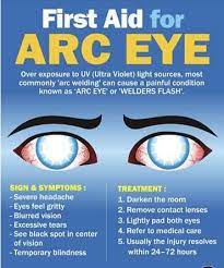Arc Eye First Aid Severe Headache How To Remove Medical