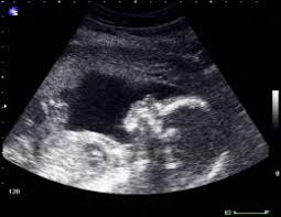 Schwangerschaftswoche wächst vor allem das gehirn. Schwanger Ihr Baby 19 Wochen Alt Ssw 21 Babywelten Ch