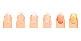 what your nails reveal about your inner nutrition status