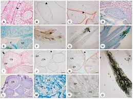 Image result for Stipularia