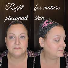 Has anyone used John Burns in Dallas for a smass facelift?