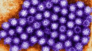 You can get norovirus from: Dnuy5zuezubpem
