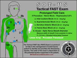 Image result for FAST Exam