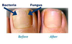 Nail Cream Rx Family Pharmacy