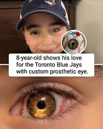 8 year old boy Logan Dorna shows his love for the Toronto Blue Jays 🐦 ⚾️  with custom prosthetic eye. 👁 #baseballfan #fan #MLB #baseball #playoffs