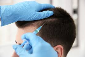 Top 10 Best Hair Transplant Clinics In Turkey Pouted Com In 2020 Best Hair Transplant Prp Hair Hair Transplant