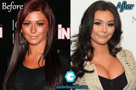 Learn the facts, costs, and dangers of cosmetic surgery for men which has been gaining popularity more and more every year. Jwoww Plastic Surgery Boob Job Botox Before And After Photos Celebritieswith Com