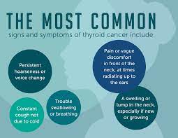 A lump or bump somewhere else in the neck: Thyroid Cancer Symptoms And Signs Dana Farber Cancer Institute
