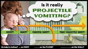 Is It Really Projectile Vomiting Juniordoctorsuk