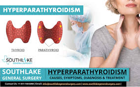 Image result for Hyperparathyroidism