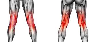Kostokondritis tidak mengancam nyawa karena biasanya kondisi satu ini akan hilang setelah beberapa hari. Penyebab Dan Pengobatan Nyeri Lutut Medkes